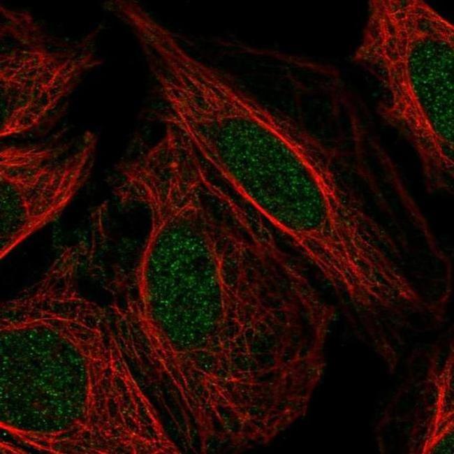 PFKFB2 Antibody in Immunocytochemistry (ICC/IF)