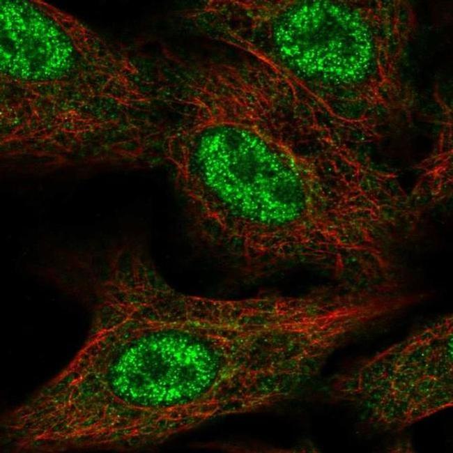 FAM96A Antibody in Immunocytochemistry (ICC/IF)