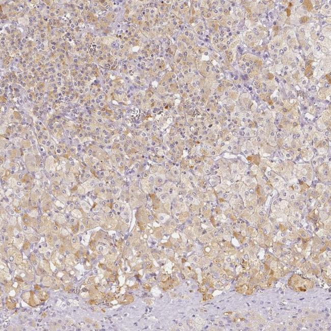 SLC18A1 Antibody in Immunohistochemistry (IHC)