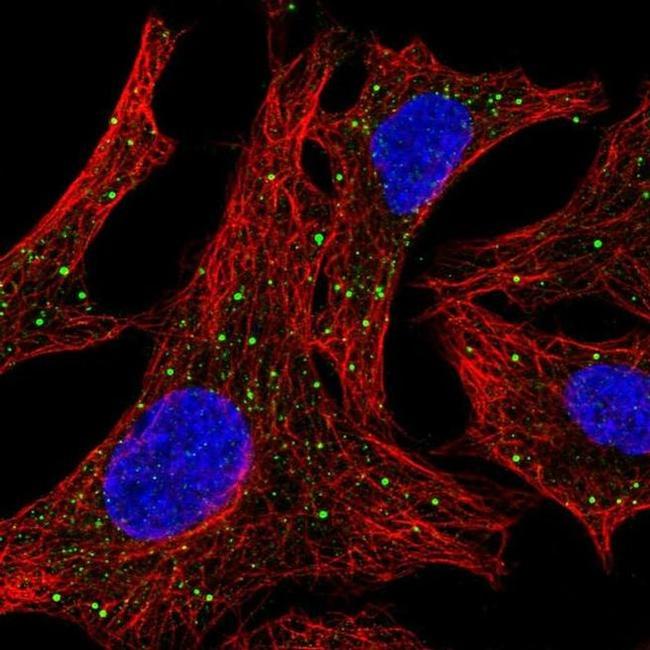 Arylsulfatase D Antibody in Immunocytochemistry (ICC/IF)