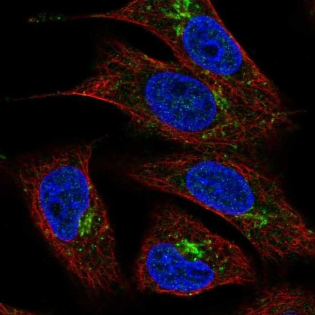 TMEM5 Antibody in Immunocytochemistry (ICC/IF)