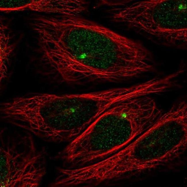 ZMYM1 Antibody in Immunocytochemistry (ICC/IF)