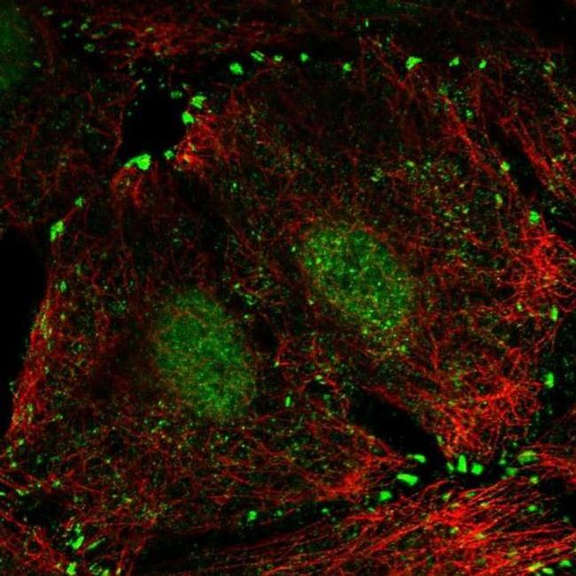 LIMD1 Antibody in Immunocytochemistry (ICC/IF)