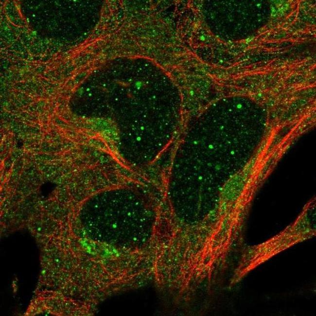 GTPBP1 Antibody in Immunocytochemistry (ICC/IF)