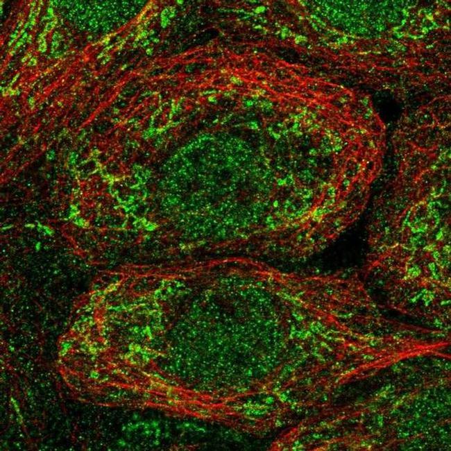 OAT Antibody in Immunocytochemistry (ICC/IF)