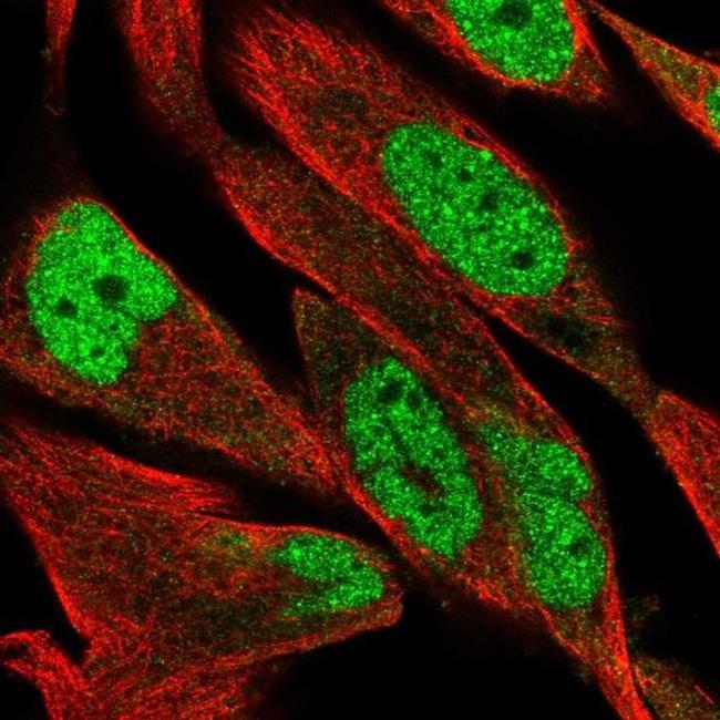 DCLRE1B Antibody in Immunocytochemistry (ICC/IF)