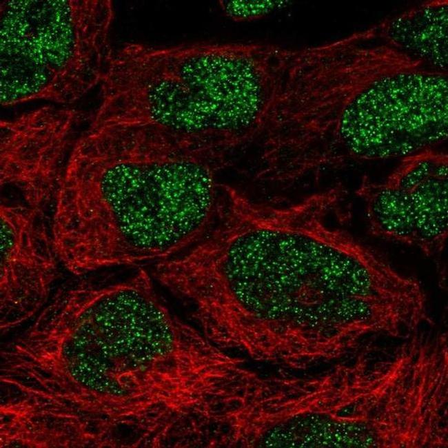 NAALAD2 Antibody in Immunocytochemistry (ICC/IF)