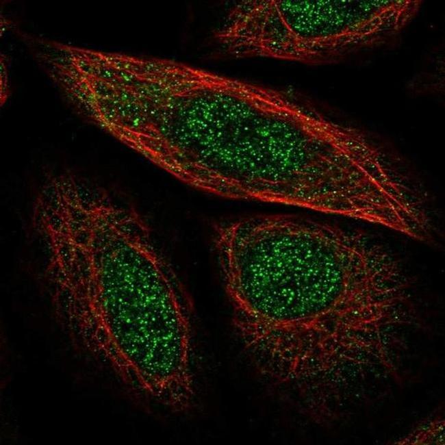 SYCP2 Antibody in Immunocytochemistry (ICC/IF)