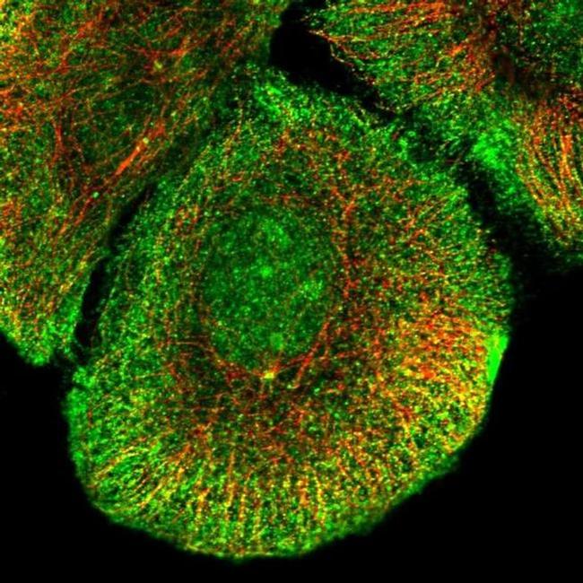 KV2.2 (KCNB2) Antibody in Immunocytochemistry (ICC/IF)