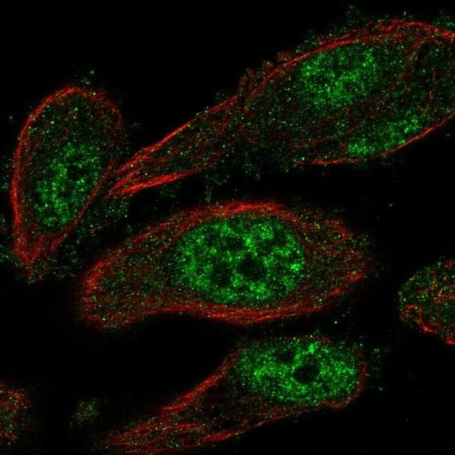 TEAD2 Antibody in Immunocytochemistry (ICC/IF)