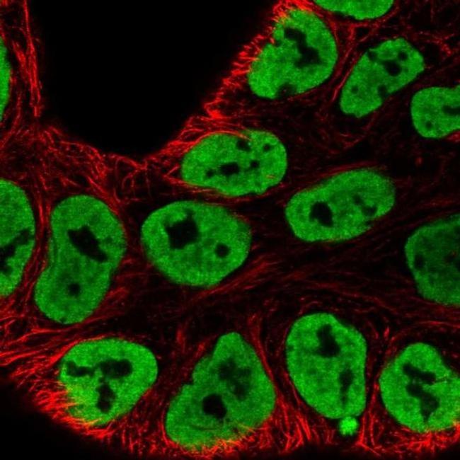 hnRNP A3 Antibody in Immunocytochemistry (ICC/IF)