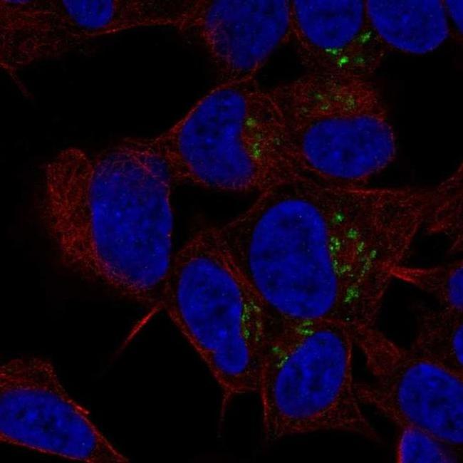 ST8SIA3 Antibody in Immunocytochemistry (ICC/IF)