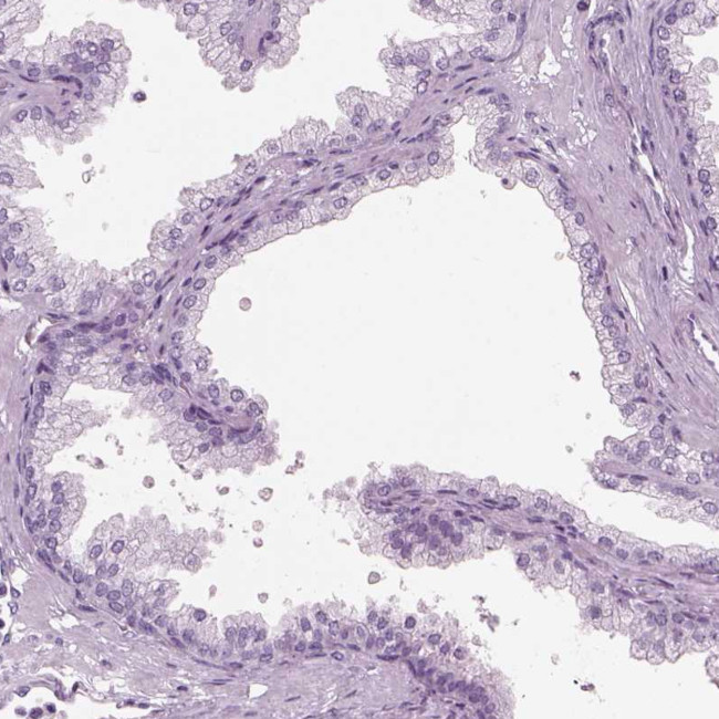 HYDIN Antibody in Immunohistochemistry (Paraffin) (IHC (P))