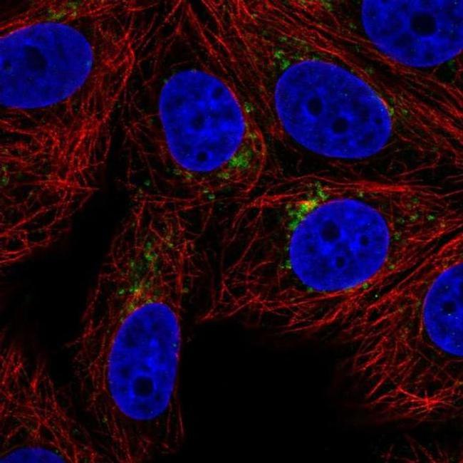 SPPL2A Antibody in Immunocytochemistry (ICC/IF)