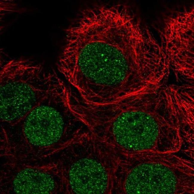 PIAS3 Antibody in Immunocytochemistry (ICC/IF)