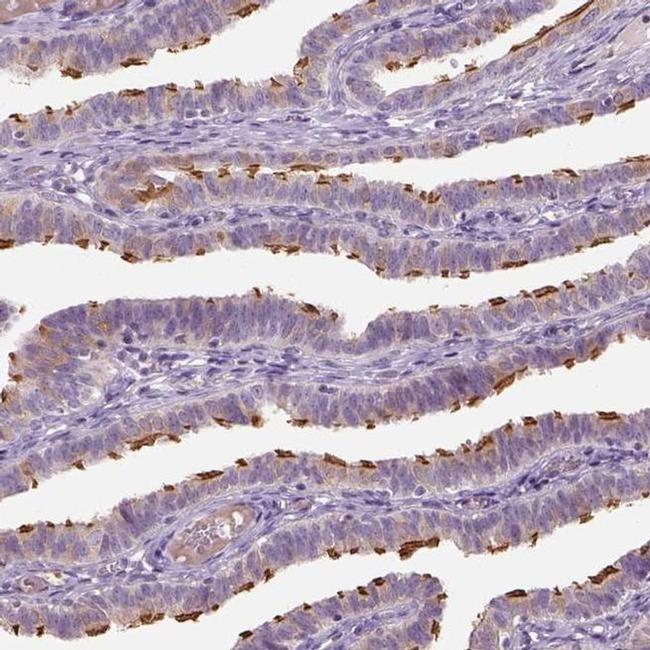 IFT52 Antibody in Immunohistochemistry (IHC)