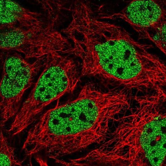 GPS2 Antibody in Immunocytochemistry (ICC/IF)