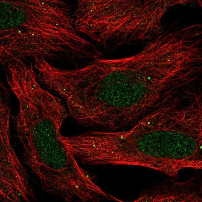 SLC30A3 Antibody in Immunocytochemistry (ICC/IF)