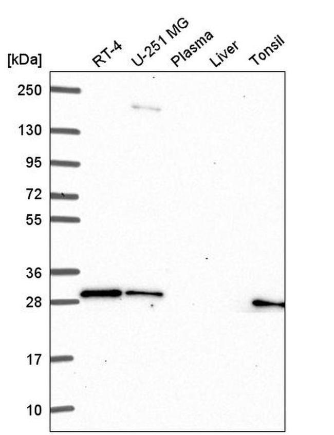 GBX2 Antibody in Western Blot (WB)