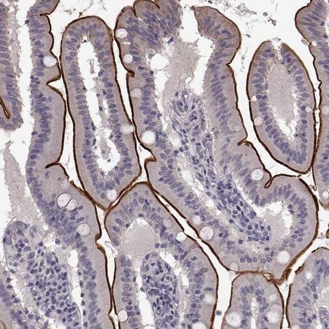 SLC22A18 Antibody in Immunohistochemistry (IHC)