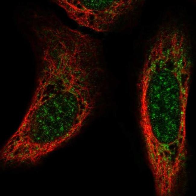 CSPG5 Antibody in Immunocytochemistry (ICC/IF)