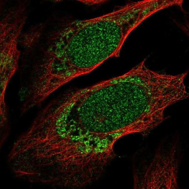 ZNF223 Antibody in Immunocytochemistry (ICC/IF)