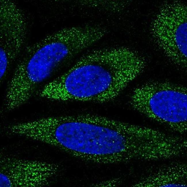 ANKH Antibody in Immunocytochemistry (ICC/IF)