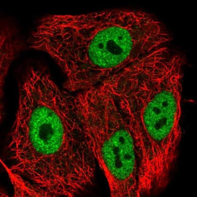 GRINL1A Antibody in Immunocytochemistry (ICC/IF)