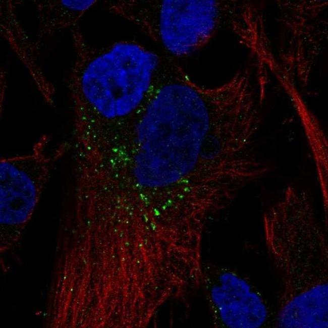 RAB5B Antibody in Immunocytochemistry (ICC/IF)