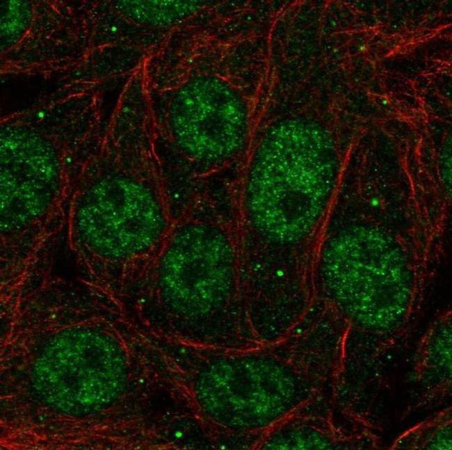 PCBP1 Antibody in Immunocytochemistry (ICC/IF)