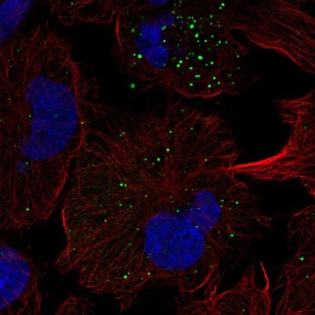 FGFR5 Antibody in Immunocytochemistry (ICC/IF)