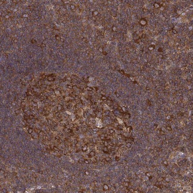 CAD Antibody in Immunohistochemistry (IHC)