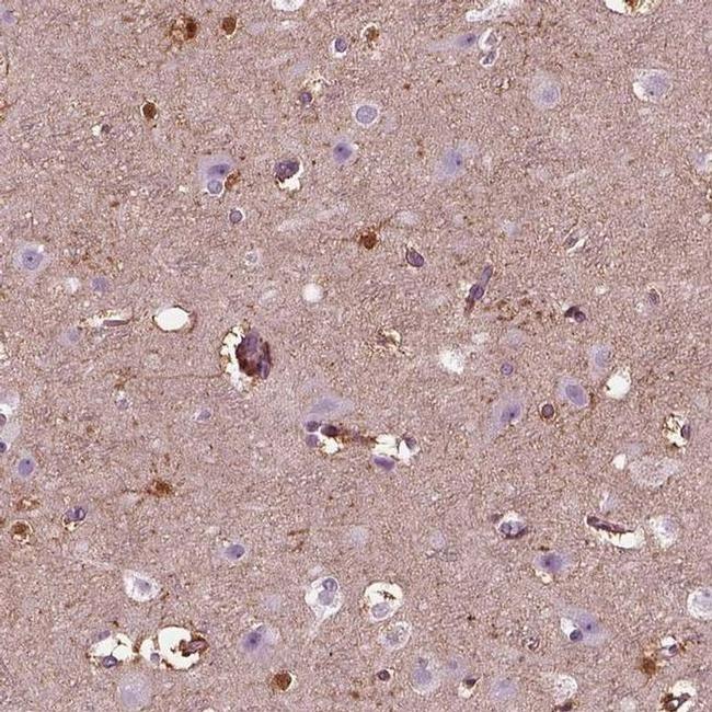 GDF11 Antibody in Immunohistochemistry (IHC)