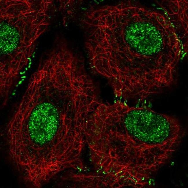 OVCA1 Antibody in Immunocytochemistry (ICC/IF)