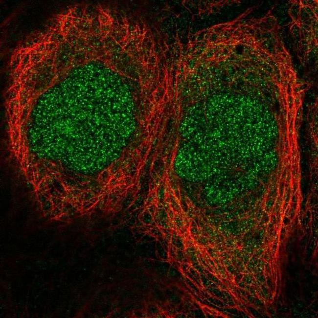 MESP1 Antibody in Immunocytochemistry (ICC/IF)