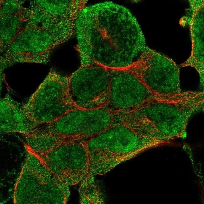 NSD1 Antibody in Immunocytochemistry (ICC/IF)