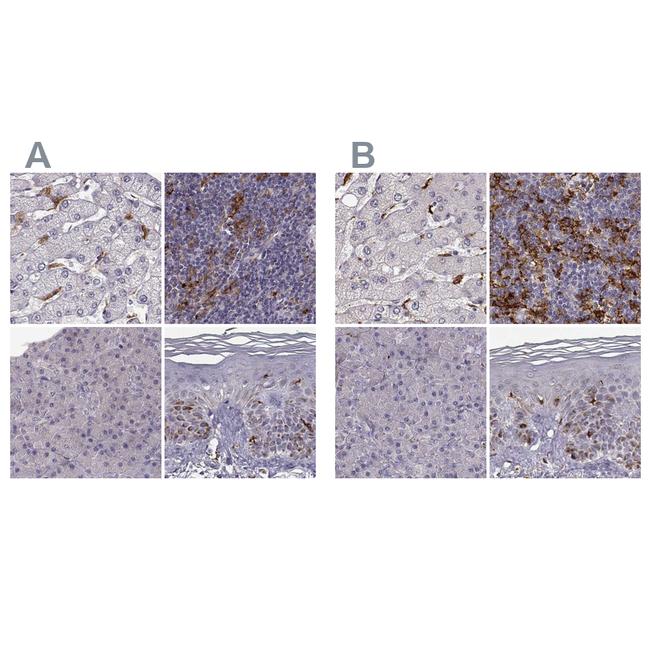 Cyclin F Antibody in Immunohistochemistry (IHC)