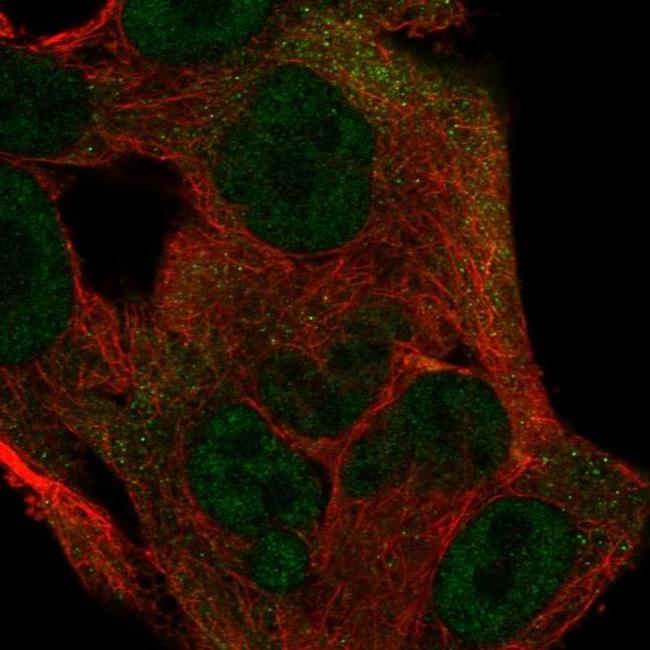 ITGB1BP1 Antibody in Immunocytochemistry (ICC/IF)