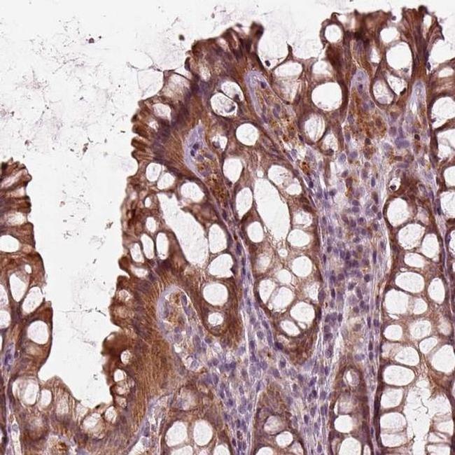 SLC25A46 Antibody in Immunohistochemistry (IHC)