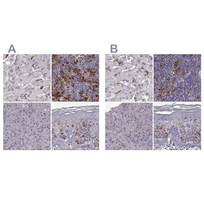 Cyclin F Antibody in Immunohistochemistry (IHC)