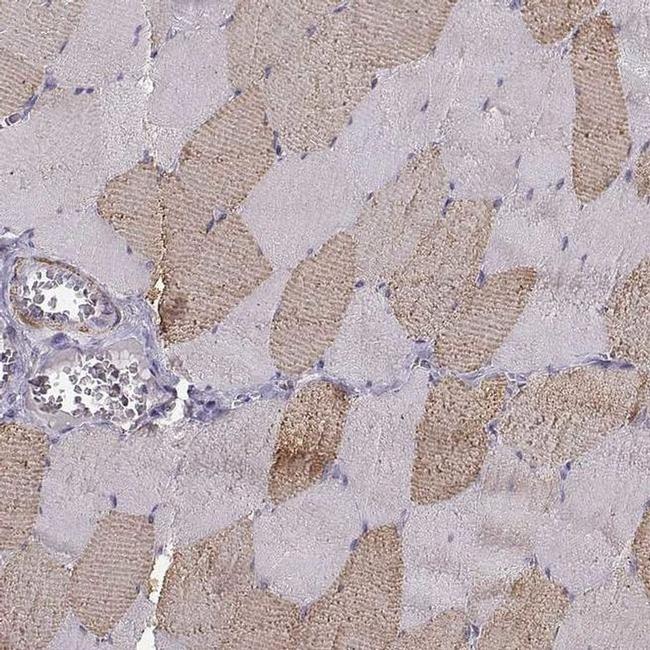 UCP3 Antibody in Immunohistochemistry (IHC)