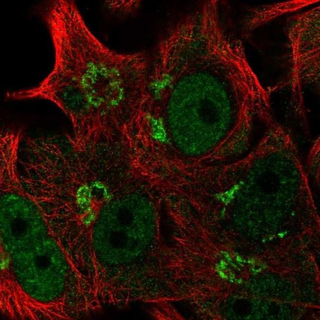 FAPP2 Antibody in Immunocytochemistry (ICC/IF)