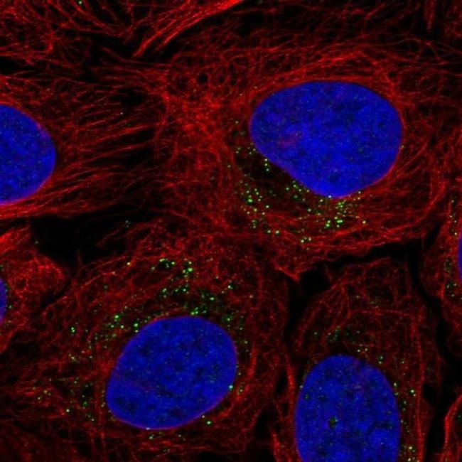 ROS1 Antibody in Immunocytochemistry (ICC/IF)