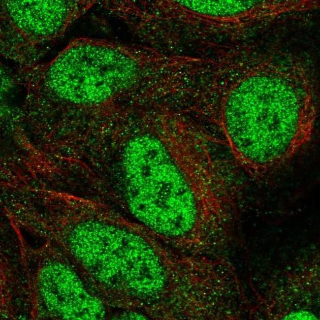 GOT1 Antibody in Immunocytochemistry (ICC/IF)