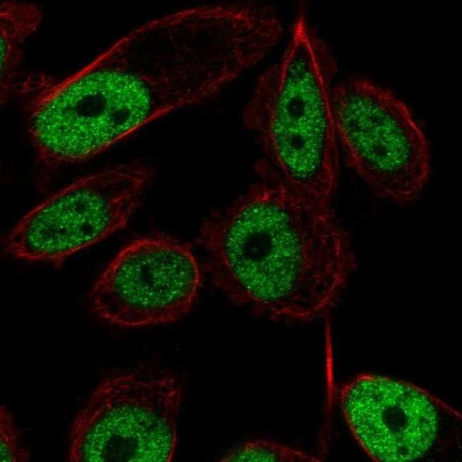 ZNF473 Antibody in Immunocytochemistry (ICC/IF)