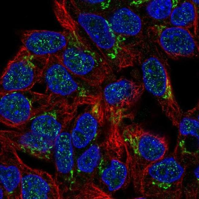 PHKB Antibody in Immunocytochemistry (ICC/IF)