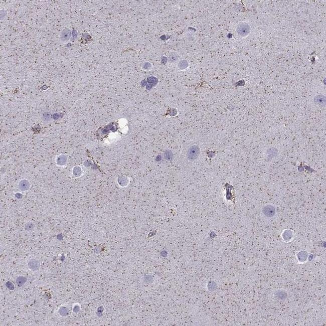 FEZF1 Antibody in Immunohistochemistry (IHC)