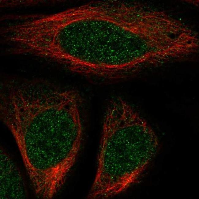 HOXA7 Antibody in Immunocytochemistry (ICC/IF)