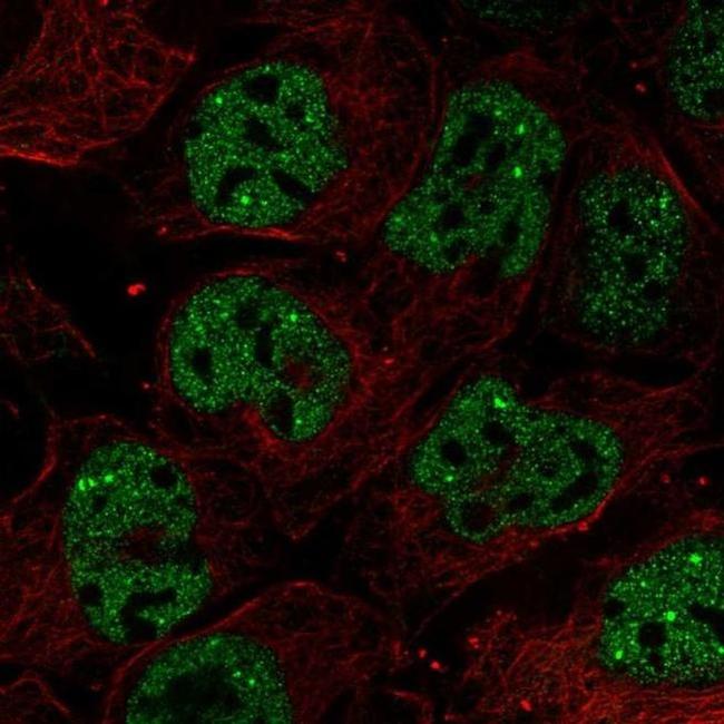 RNF34 Antibody in Immunocytochemistry (ICC/IF)