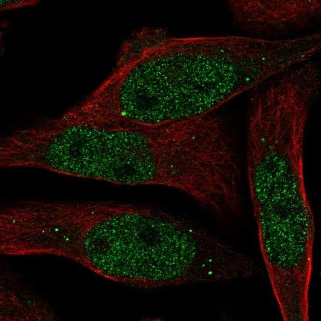 RAB8B Antibody in Immunocytochemistry (ICC/IF)